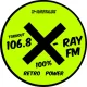 X-Ray FM